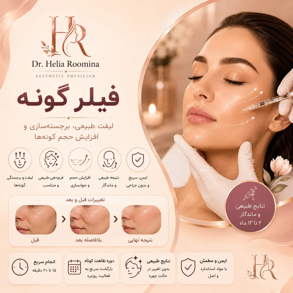 فیلر گونه, تزریق فیلر گونه, ژل گونه, تزریق ژل گونه, برجسته سازی گونه, حجم دهی گونه, فرم دهی گونه, کانتورینگ صورت, زاویه سازی صورت, لیفت گونه, فیلر هیالورونیک اسید, Hyaluronic Acid Filler, Cheek Filler, Cheek Augmentation, Cheek Enhancement, Facial Contouring, Midface Volumization, Face Sculpting, Non Surgical Face Lift, Dermal Filler, زیبایی صورت, جوانسازی صورت, Facial Rejuvenation, Aesthetic Medicine, Cosmetic Treatment, Anti Aging, دکتر هلیا رومینا, Helia Roomina, Dr  Helia Roomina