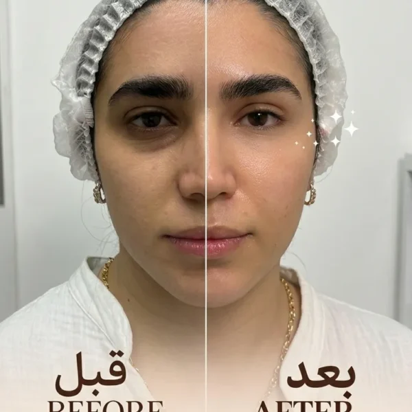 IMG 3745 600x600