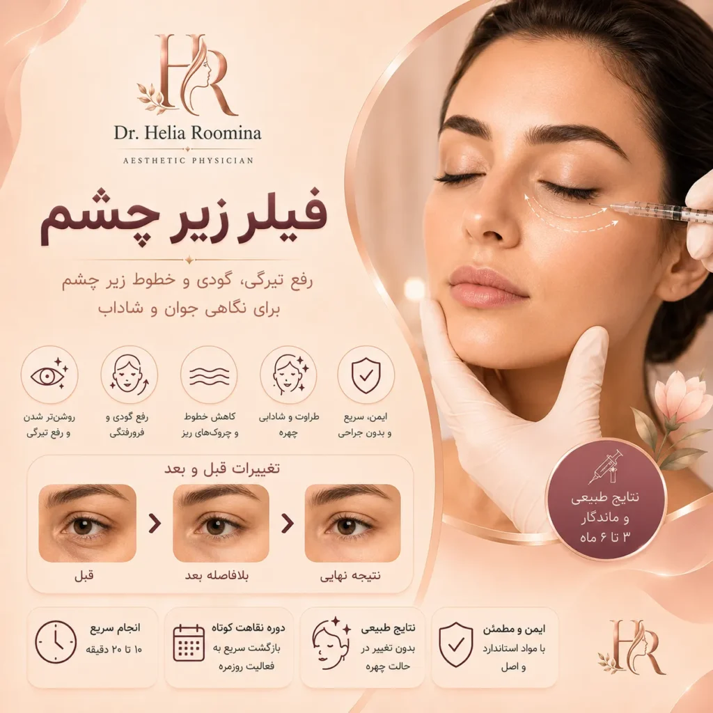 فیلر زیر چشم, تزریق فیلر زیر چشم, ژل زیر چشم, تزریق ژل زیر چشم, رفع گودی زیر چشم, درمان گودی زیر چشم, درمان تیرگی زیر چشم, جوانسازی زیر چشم, جوانسازی دور چشم, فیلر هیالورونیک اسید, Hyaluronic Acid Filler, Under Eye Filler, Tear Trough Filler, Tear Trough Correction, Under Eye Rejuvenation, Dark Circle Treatment, Hollow Under Eyes, Eye Rejuvenation, Dermal Filler, Facial Rejuvenation, Aesthetic Medicine, Cosmetic Treatment, Anti Aging, زیبایی دور چشم, دکتر هلیا رومینا, Helia Roomina, Dr  Helia Roomina