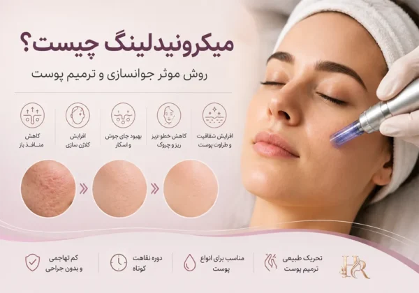 میکرونیدلینگ, جوانسازی پوست, جای جوش, منافذ باز پوست, کلاژن سازی, درمان اسکار آکنه, خطوط ریز صورت, لک های پوستی, ترمیم پوست, درماپن, جوانسازی غیرجراحی, الاستین پوست, رفع چروک, پوست شفاف, مراقبت بعد از میکرونیدلینگ, عوارض میکرونیدلینگ, بی حسی موضعی, ترک های پوستی, اسکار برجسته, کلوئید, آکنه فعال, تبخال, ضدآفتاب, پوسته ریزی, قرمزی پوست, تورم پوست, سرم ترمیم کننده, مشاوره پوست, انواع پوست, دوره نقاهت, نتایج میکرونیدلینگ, جلسات درمانی Microneedling, Skin rejuvenation, Acne scars, Collagen induction therapy, Fine lines, Open pores, Skin texture, Dermaroller, Dermapen, Collagen production, Elastin, Skin resurfacing, Minimally invasive, Skin tightening, Hyperpigmentation, Stretch marks, Non surgical facial, Skin remodeling, Micro injuries, PRP microneedling, Skin needling, Collagen synthesis, Scar treatment, Pore minimization, Skin radiance, Post treatment care, Microneedling side effects, Local anesthesia, Skin peeling, Redness, Swelling, Healing serums, Skin consultation, Downtime, Treatment sessions, Keloid, Active acne, Herpes, Sunscreen
