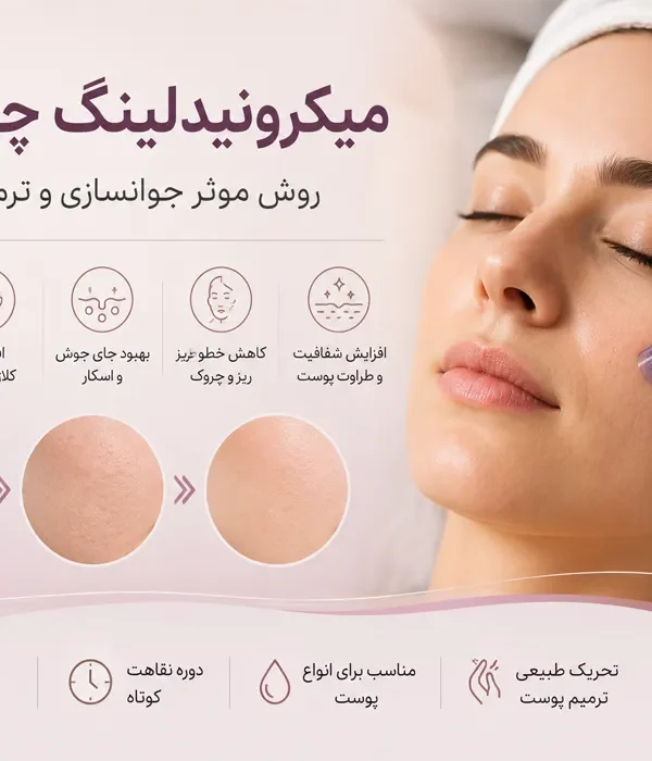میکرونیدلینگ, جوانسازی پوست, جای جوش, منافذ باز پوست, کلاژن سازی, درمان اسکار آکنه, خطوط ریز صورت, لک های پوستی, ترمیم پوست, درماپن, جوانسازی غیرجراحی, الاستین پوست, رفع چروک, پوست شفاف, مراقبت بعد از میکرونیدلینگ, عوارض میکرونیدلینگ, بی حسی موضعی, ترک های پوستی, اسکار برجسته, کلوئید, آکنه فعال, تبخال, ضدآفتاب, پوسته ریزی, قرمزی پوست, تورم پوست, سرم ترمیم کننده, مشاوره پوست, انواع پوست, دوره نقاهت, نتایج میکرونیدلینگ, جلسات درمانی Microneedling, Skin rejuvenation, Acne scars, Collagen induction therapy, Fine lines, Open pores, Skin texture, Dermaroller, Dermapen, Collagen production, Elastin, Skin resurfacing, Minimally invasive, Skin tightening, Hyperpigmentation, Stretch marks, Non surgical facial, Skin remodeling, Micro injuries, PRP microneedling, Skin needling, Collagen synthesis, Scar treatment, Pore minimization, Skin radiance, Post treatment care, Microneedling side effects, Local anesthesia, Skin peeling, Redness, Swelling, Healing serums, Skin consultation, Downtime, Treatment sessions, Keloid, Active acne, Herpes, Sunscreen