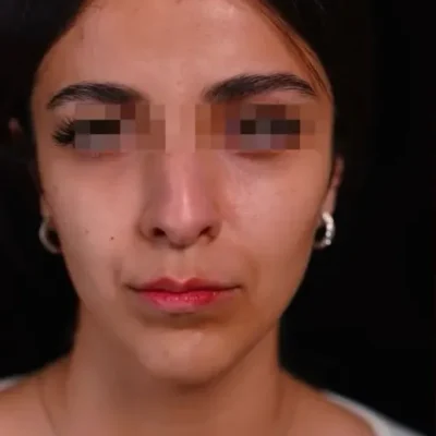 قبل مادلینگ