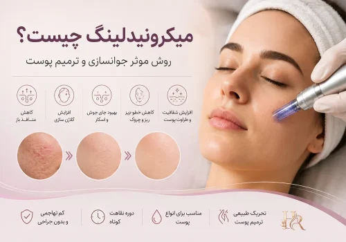 میکرونیدلینگ, جوانسازی پوست, جای جوش, منافذ باز پوست, کلاژن سازی, درمان اسکار آکنه, خطوط ریز صورت, لک های پوستی, ترمیم پوست, درماپن, جوانسازی غیرجراحی, الاستین پوست, رفع چروک, پوست شفاف, مراقبت بعد از میکرونیدلینگ, عوارض میکرونیدلینگ, بی حسی موضعی, ترک های پوستی, اسکار برجسته, کلوئید, آکنه فعال, تبخال, ضدآفتاب, پوسته ریزی, قرمزی پوست, تورم پوست, سرم ترمیم کننده, مشاوره پوست, انواع پوست, دوره نقاهت, نتایج میکرونیدلینگ, جلسات درمانی Microneedling, Skin rejuvenation, Acne scars, Collagen induction therapy, Fine lines, Open pores, Skin texture, Dermaroller, Dermapen, Collagen production, Elastin, Skin resurfacing, Minimally invasive, Skin tightening, Hyperpigmentation, Stretch marks, Non-surgical facial, Skin remodeling, Micro-injuries, PRP microneedling, Skin needling, Collagen synthesis, Scar treatment, Pore minimization, Skin radiance, Post-treatment care, Microneedling side effects, Local anesthesia, Skin peeling, Redness, Swelling, Healing serums, Skin consultation, Downtime, Treatment sessions, Keloid, Active acne, Herpes, Sunscreen