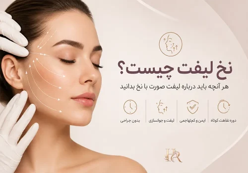 نخ-لیفت